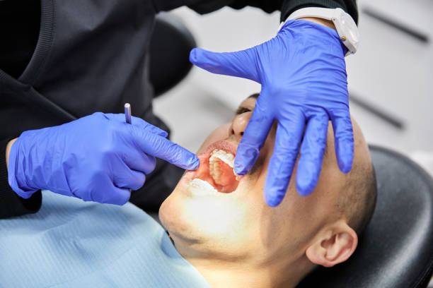 Best Broken or Chipped Tooth Repair in Peru, IN